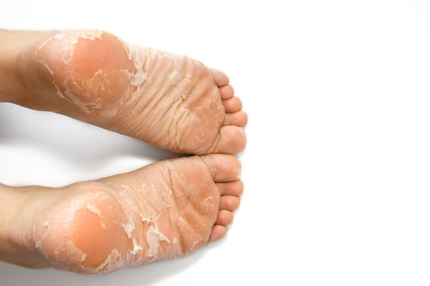 Podiatrist Coral Springs FL | Podiatrist Tamarac FL | Podiatrist Fort Lauderdale FL | Podiatrist Cooper City FL