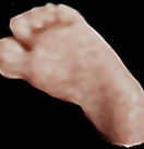 5D Ultrasound - Angelic Keepsakes
