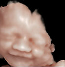 5D Ultrasound - Angelic Keepsakes
