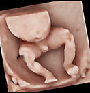 5D Ultrasound - Angelic Keepsakes