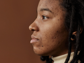 What causes dark marks to become deeply embedded in the skin?