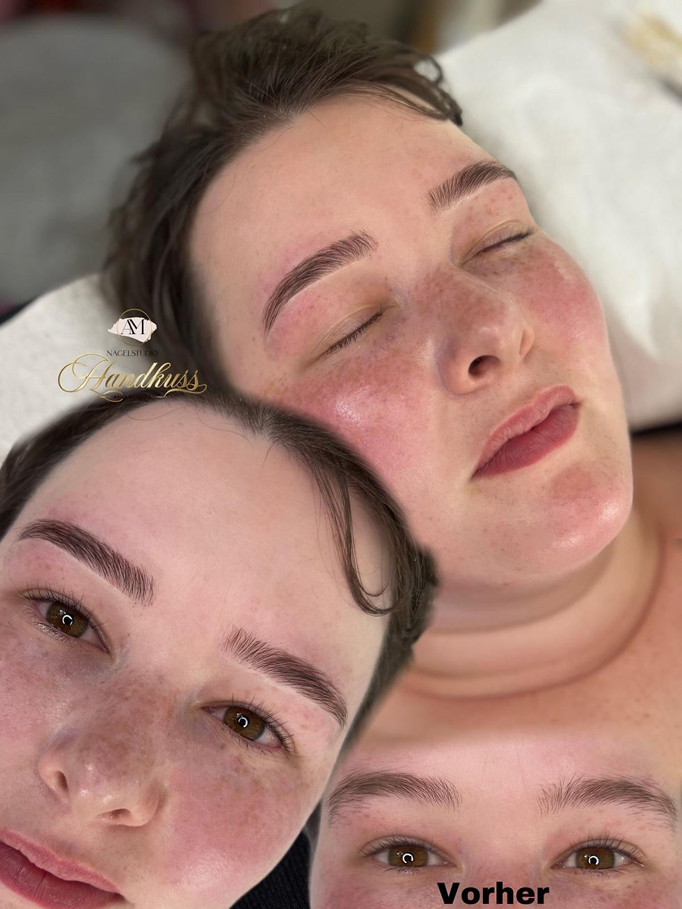 Augenbrauenlifting 3