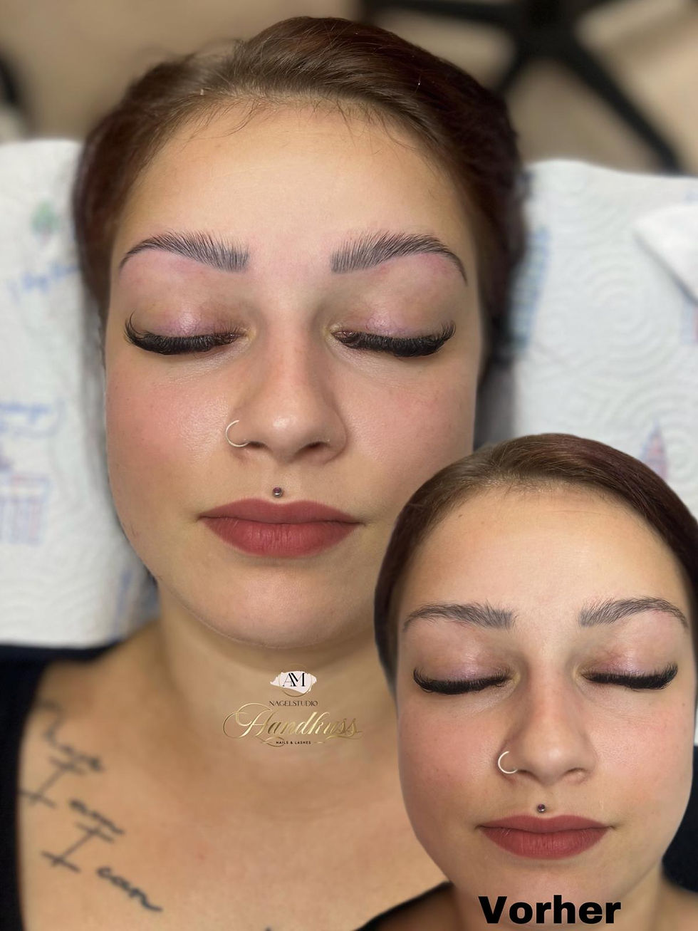 Augenbrauenlifting 1