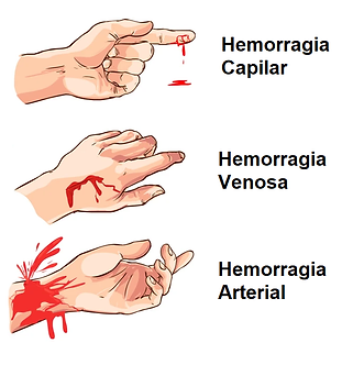 hemorrafgias.png
