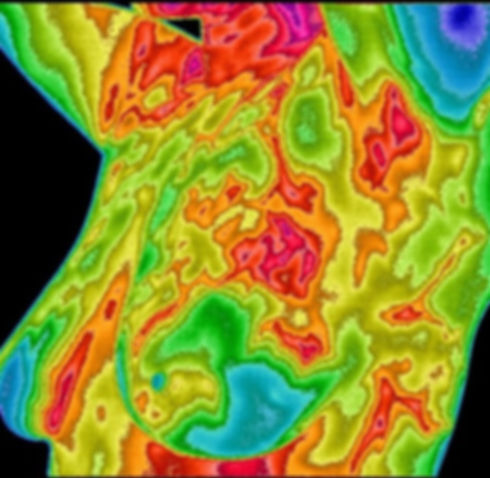 breast thermography scan from the left side