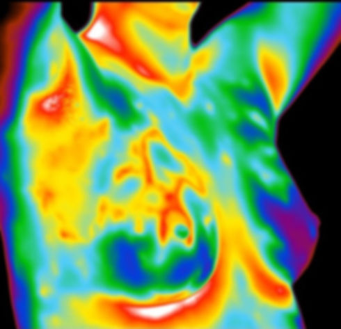 breast thermography scan with arms up