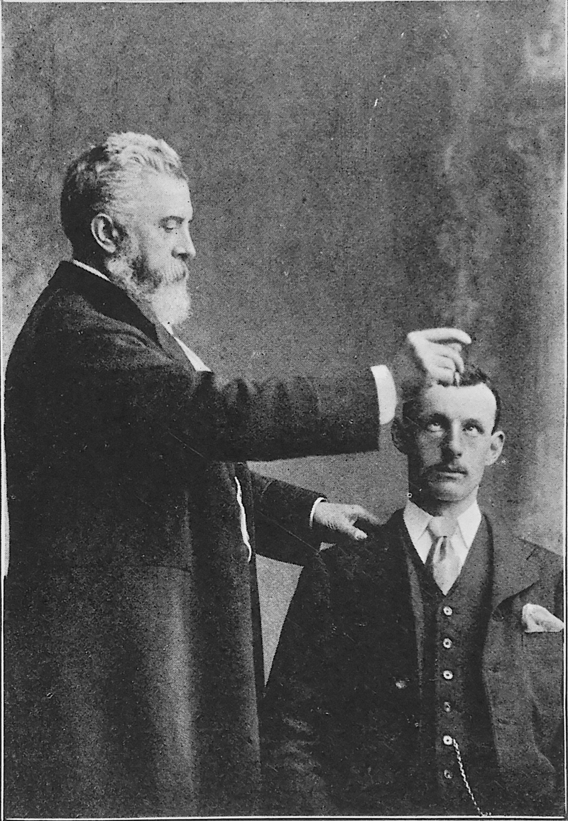 Braid's "upwards and inwards squint" induction method, as demonstrated by James Coates (1843–1933) in 1904.