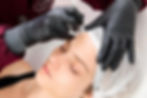harmonização facial