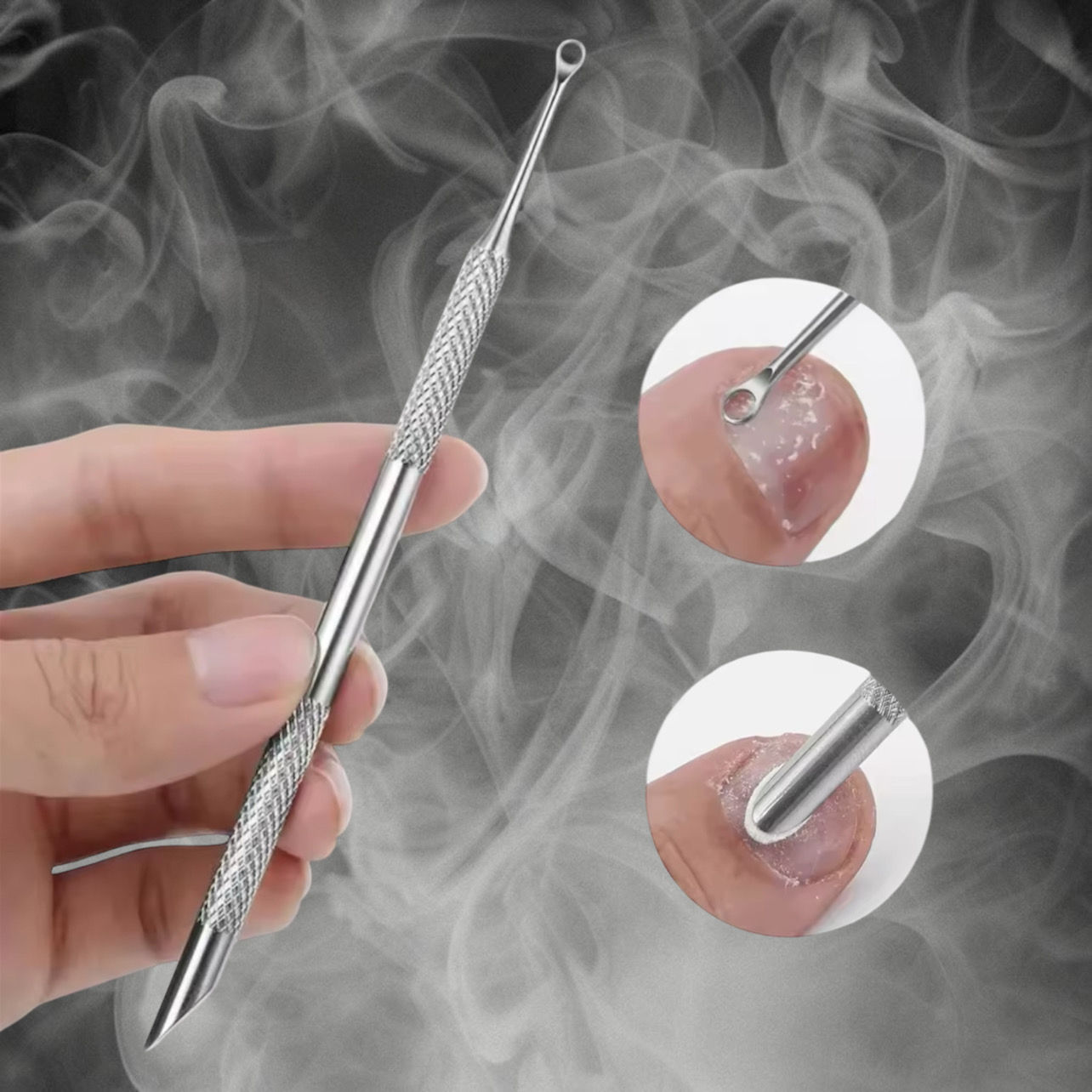 Etch 'N' Prep Nail Etching Tool Starter Pack