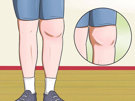 Exercising with knee osteoarthritis