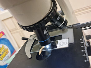 Macrorhabdus (Avian Gastric Yeast/Megabacteria)