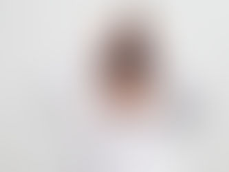 Tontura em Crianças e Adolescentes: Quando procurar um Otorrino?