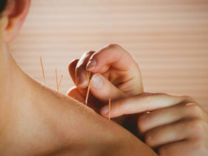 O que a acupuntura pode ajudar na saúde feminina?