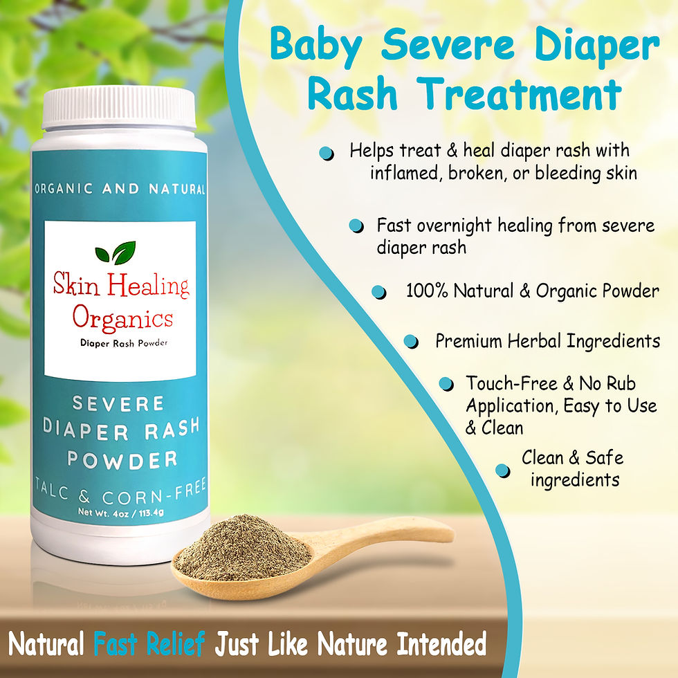 Thumbnail: Baby Severe Diaper Rash Powder Treatment