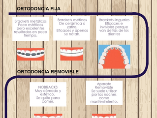 Diferencias entre los tipos de ortodoncia