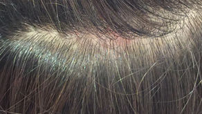 あ.うん　美髪テクニック簡単バージョン