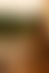 Gölge mi Güneş mi? Balkon Tercihinde Sağlık ve Konfor Dengesi