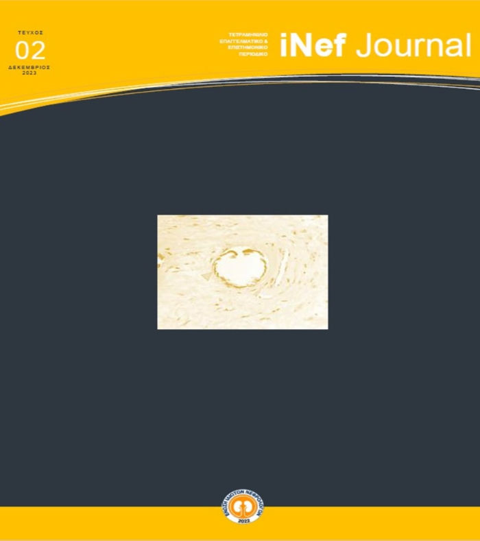 iNefJ-02