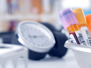 The Perimenopause Testing Trap: Why Your Labs Might Be Lying to You 