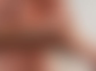 Sintomas “estranhos” da esclerose múltipla que muita gente não associa à doença