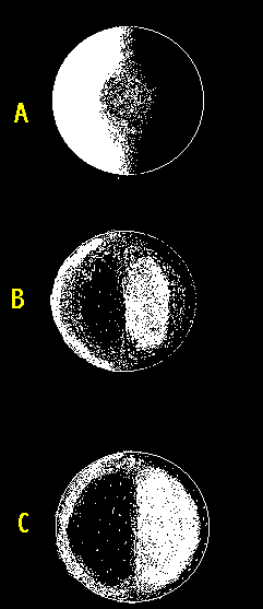 sphericalovercorrection.gif