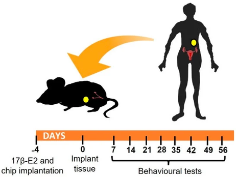 Endometriosis-Associated Pain: Home Cage Analyser enables refinement of mouse model
