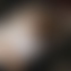 Polycystic Ovary Syndrome and Mental Isolation