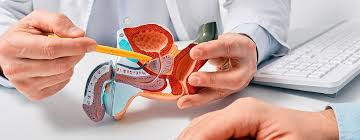 Pronóstico, riesgos y complicaciones del cáncer de próstata.