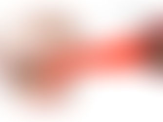 Cancro da vesícula biliar - o que é, sintomas, diagnóstico e tratamento