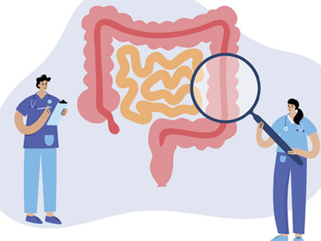 Rastreio do cancro colorretal - quando começar, que exames fazer e marcadores tumorais