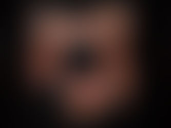 Colonoscopia virtual - o que é, indicações e o que acontece durante o exame