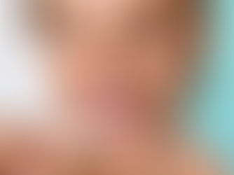 Clear Aligners in Wangsa Maju & Sri Rampai: What You Need to Know