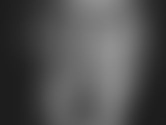 How ACC Works for Acupuncture (Without the Headache)