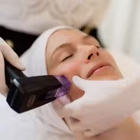 Morpheus8 Skin Tightening in Fairfax, VA