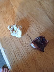 fungus toenails