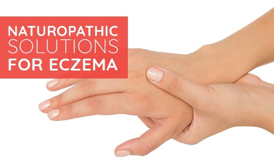 How to Cure Eczema Permanently through Naturopathy