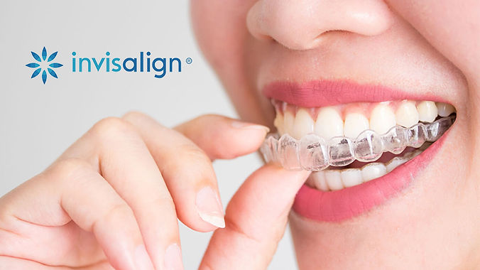 invisalign-farmington-hills.jpg