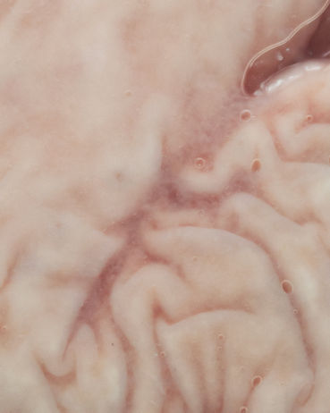 Day 6 - Gut to get your bowels in an uproar_.jpg