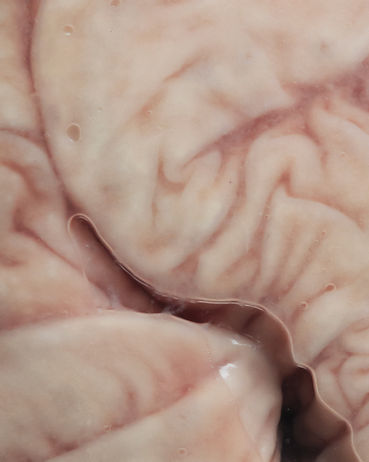 Day 7 - Gut to bare my entrails tomorrow.jpg