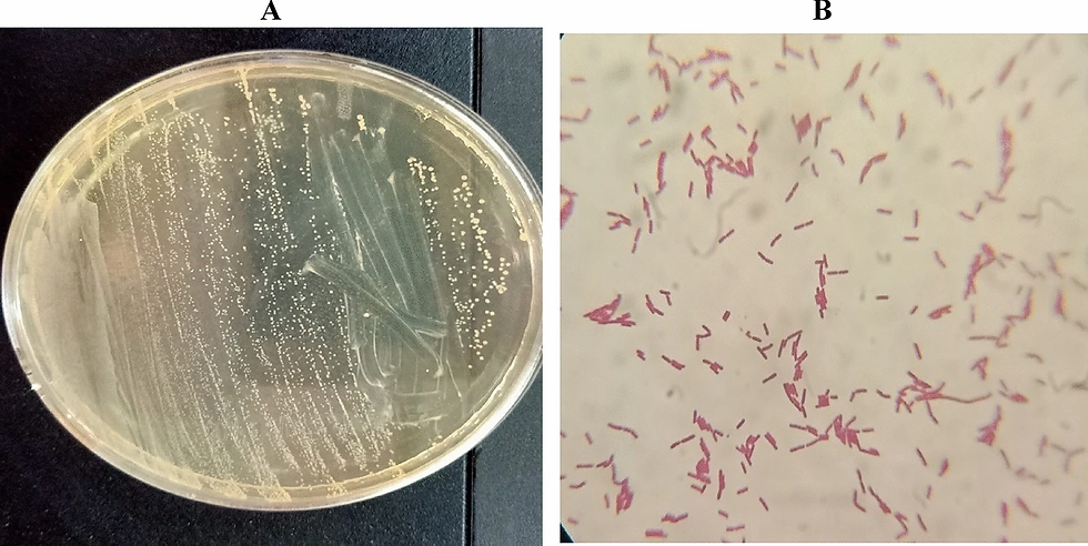 Lactiplantibacillus Plantarum