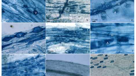 Arbuscular Mycorrhizal Fungi
