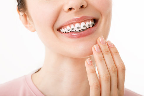 tratamiento-ortodoncia-concepto-cuidado-dental-hermosa-mujer-sonrisa-saludable-cerrar-prim