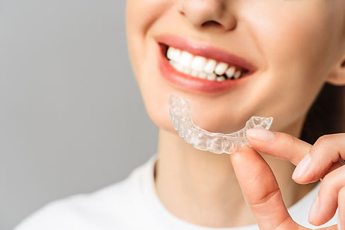mujer-joven-hace-procedimiento-blanqueamiento-dientes-casa-bandeja-blanqueamiento-gel.jpg