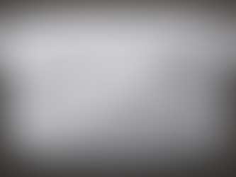 Crossbite o Mordida Cruzada