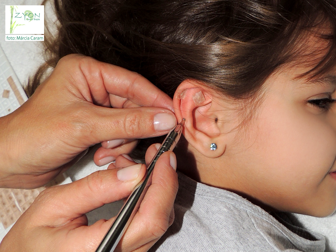 Curso: Acupuntura Auricular