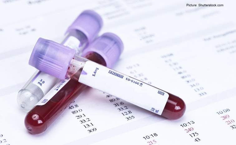 Blood Test