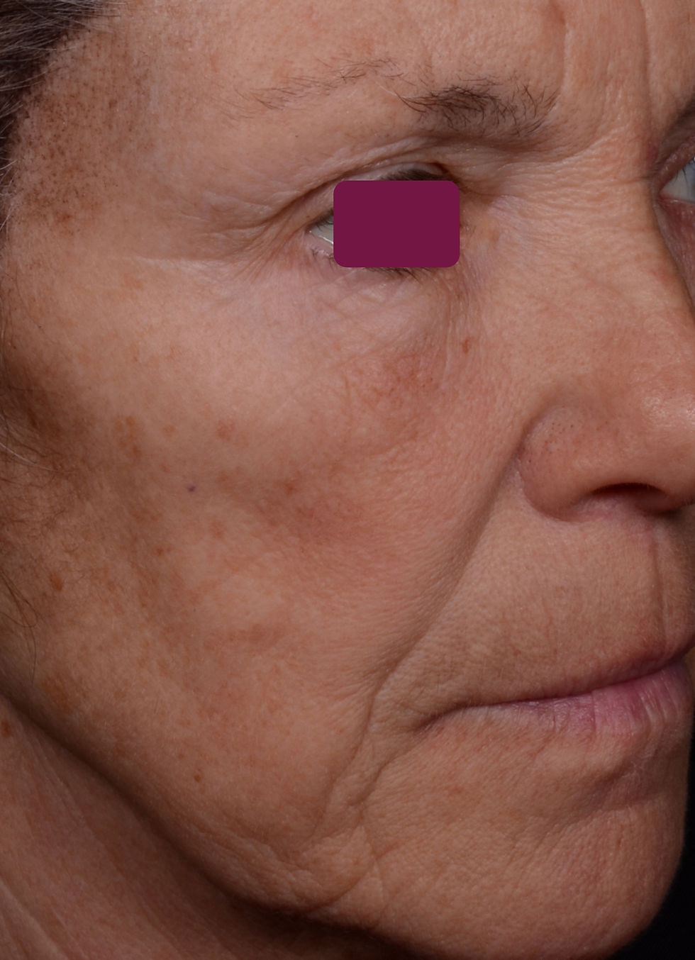 Thumbnail: older woman results from using actives