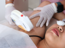 treatment laser