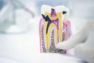 canal-odontologia_edited.jpg