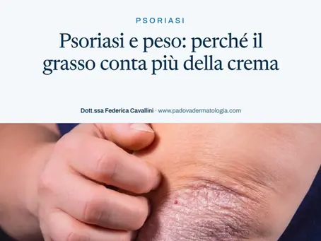 Psoriasi e peso: perché il grasso conta più della crema